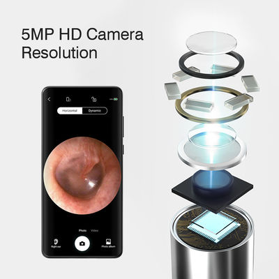 3.9mm HD Dijital WiFi Kulak Otoskobu AI Yönlendirme Fonksiyonu ve WiFi Bağlantısı ile